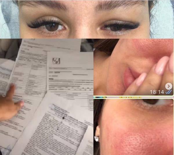&laquo;Это я клеветница и шантажистка?&raquo;: в Казани пациентка косметолога требует возмездия за страшный &laquo;укол красоты&raquo;