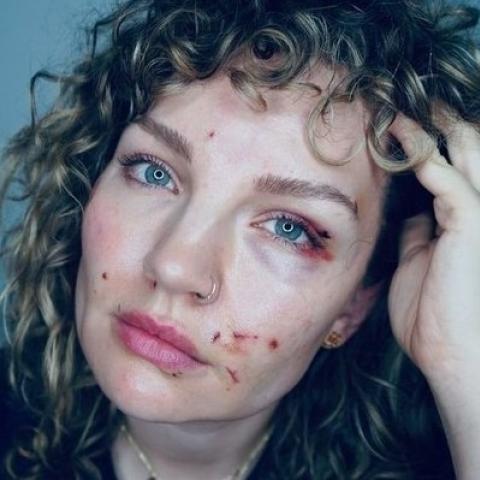 Жена хоккеиста «Ак Барса» выложила фото с разодранным лицом Жена хоккеиста «Ак Барса» выложила фото с разодранным лицом