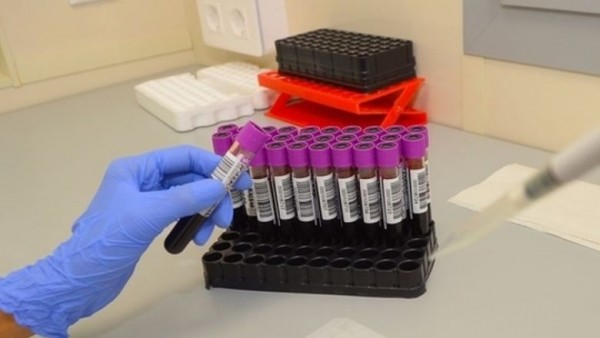 В Татарстане зарегистрировано 85 новых случаев коронавируса