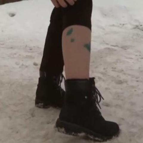 В Казани стая собак набросилась на школьницу