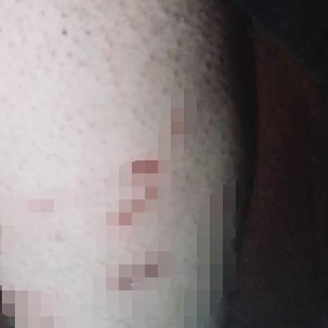 В Татарстане хозяйская собака напала на подростка и его отца: пострадавших госпитализировали