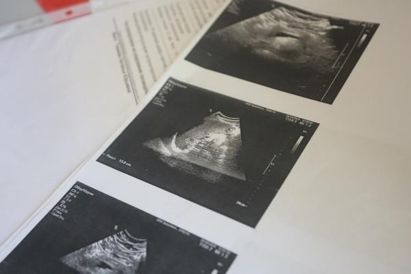 &laquo;Из-за них я осталась одна с двумя детьми и с ипотекой&raquo;: вдова 30-летнего казанца винит в его смерти врачей