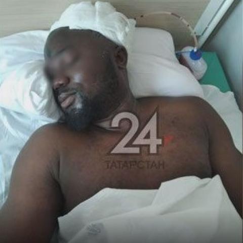 В Казани компания хулиганов жестко избила студента из Конго