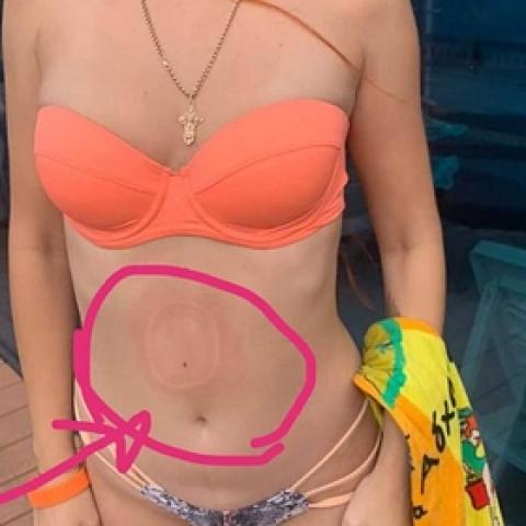 &laquo;Казалось, живот разрывается&raquo;: россиянку присосало в бассейне отеля