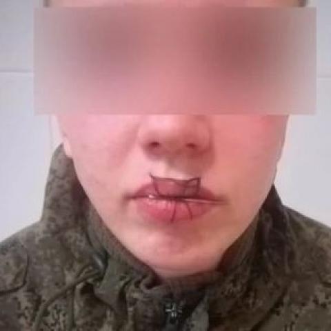 В Челябинской области солдат зашил себе рот после ссоры с девушкой