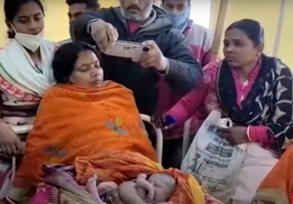 В Индии родился ребенок с четырьмя руками и ногами (ФОТО)