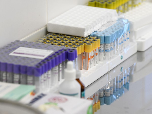 Жители Казани могут бесплатно пройти экспресс-тестирование на ВИЧ