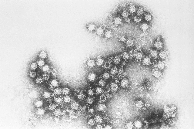 
        &laquo;Я оказался виноватый&raquo;. Задержан владелец базы, где собаки загрызла женщину    