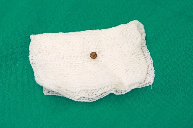 
        &laquo;Сердце продолжалось биться&raquo;. Татарстанские врачи спасли бойца СВО    