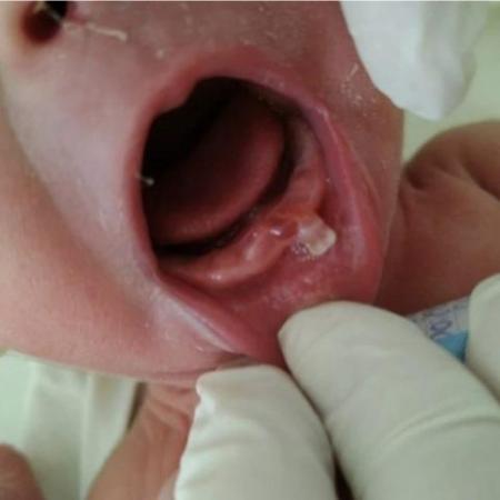 В Уфе родился малыш с редкой патологией В Уфе родился малыш с редкой патологией